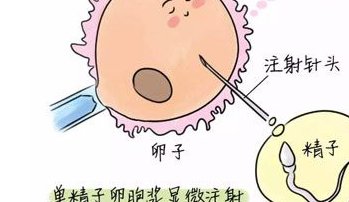 2026保山市最新男性陪产假有多少天？试管婴儿可以增加产假吗？