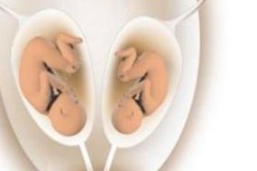 西安试管婴儿费用：从检查到手术的全部费用剖析